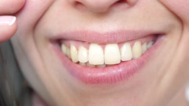 Chica hablando en un teléfono celular se ríe, dientes primer plano. mujer hablando en el teléfono inteligente y sonriendo de cerca . — Vídeos de Stock