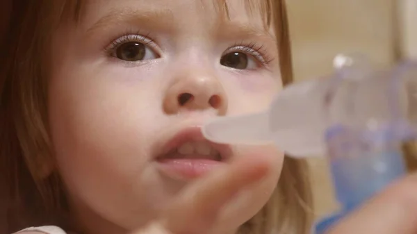 A gyermek beteg és inhalátoron keresztül lélegzik. Közelkép. Egy kislány, akit inhalációs maszkkal kezeltek az arcán egy kórházban. A kisgyermek az influenzát inhalációs gőz belélegzésével kezeli. — Stock Fotó