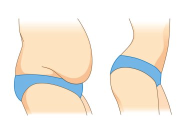 Yağlı ve ince bir vücut kadın mavi bikini. Resimde ağırlık ve farklı şekli hakkında.