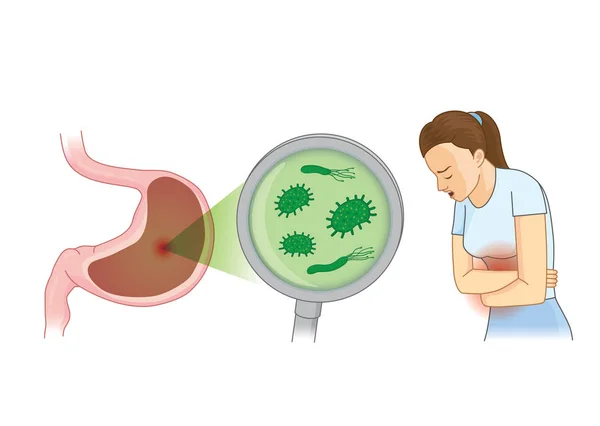 女性のための胃の痛みの症状に苦しんで細菌 衛生と健康についての概念図 — ストックベクタ