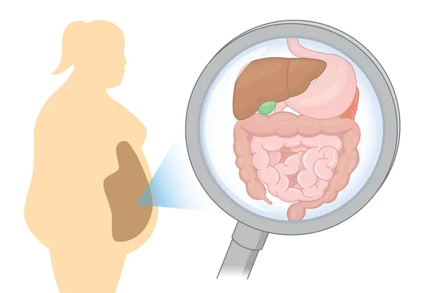 Zoom Órgão Interno Sobre Digestão Mulher Gorda Com Lupa Ilustração — Vetor de Stock