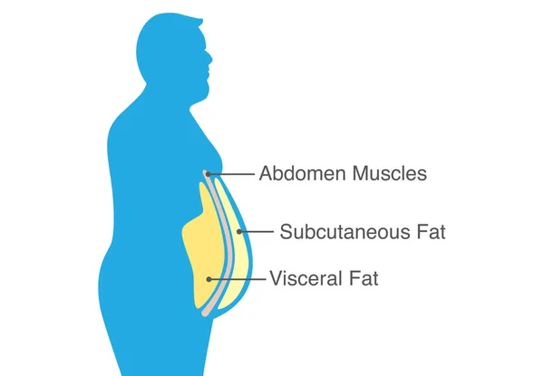 内脏脂肪和皮下脂肪堆积在你的腰围上 医学图说明 — 图库矢量图片