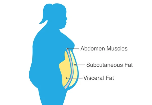 内臓脂肪と皮下脂肪は女性のウエストの周りを蓄積します イラスト医療図について — ストックベクタ