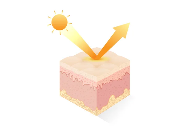 Les Rayons Soleil Pénètrent Dans Couche Profonde Peau Humaine Illustration — Image vectorielle