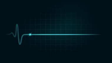 Pulse rate Line while dead on green chart background of monitor. Illustration about heart failure and Cardiogram monitor.