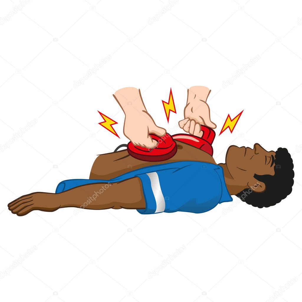 Illustration First Aid resuscitation (CPR) using defibrillator to cardiac arrest, Afro man. Ideal for training materials, catalogs and institutional