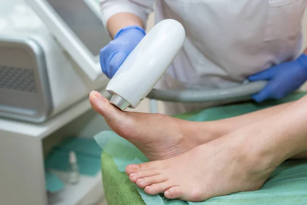 Procedure Laser Hair Removal Legs — Stock Photo, Image