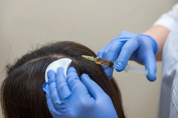 Doctor Gives Injection Scalp Hair Growth Royalty Free Stock Photos