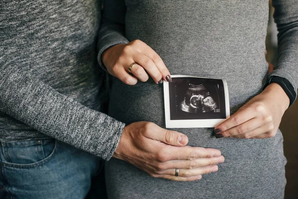 Élégant couple enceinte tenant échographie scanner de bébé sur bébé — Photo