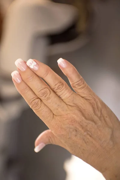 Hands Middle Aged Woman Problems Rheumatism Osteoarthritis Skin Blemishes — Stock Photo, Image