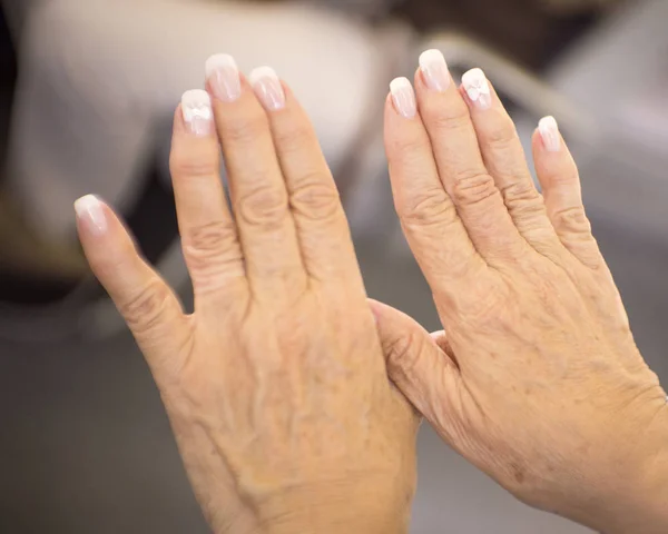 Hands of a middle aged woman with problems of rheumatism, osteoarthritis and skin blemishes
