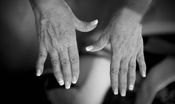Mãos Uma Mulher Meia Idade Com Problemas Reumatismo Osteoartrite Manchas — Fotografia de Stock