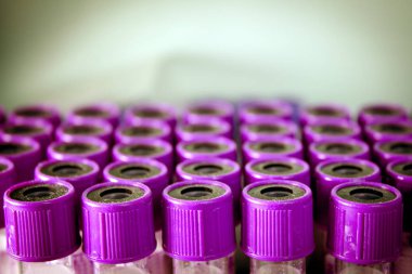 Farklı hastalıkların tedavisi veterinerlik kullanımına yönelik şişeleri. Hiçbir insan