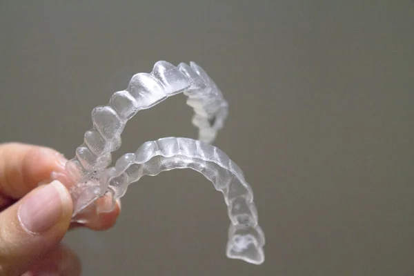 Orthodontie Dentaire Transparente Pour Corriger Alignement Dentaire Pas Peuple — Photo