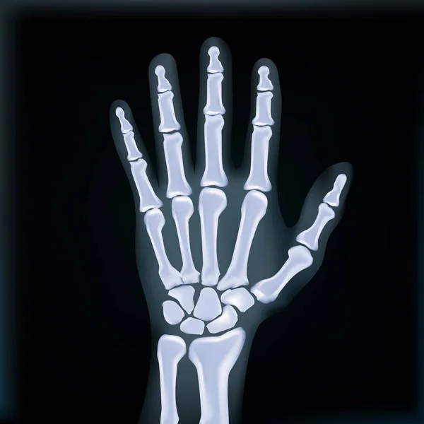 Imagen médica realista de la mano de rayos X — Archivo Imágenes Vectoriales