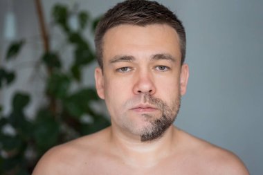 Bir tarafı sakallı, diğer tarafı tıraşlı üzgün bir adam.