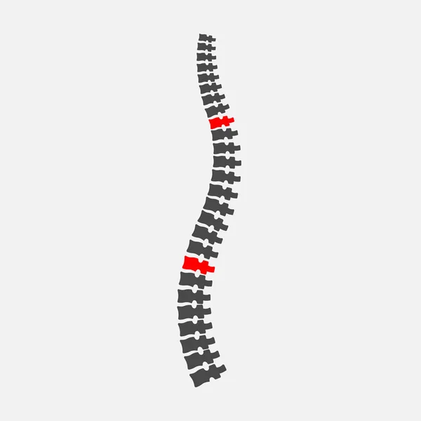 Ilustração vetorial criativa de raio-X da coluna vertebral, pescoço de dor, degradação do disco, tratamento de lesões em segundo plano. Modelo de bandeira médica de design de arte. Conceito abstrato infográfico em saúde elemento gráfico —  Vetores de Stock