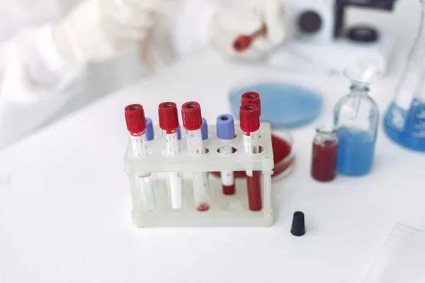 Coronavirus testing samples with bottles solutions inside and a loupe on a table — Stock Photo, Image