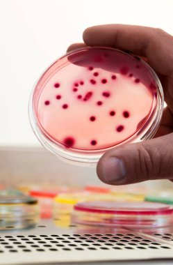 Bakteri kolonileri, Diferansiyel ve Seçici Medya kültürü. Biyoteknoloji, sağlık.