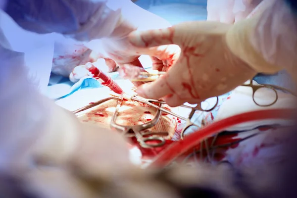 Novosibirsk Russia June 2020 一个外科小组在医院为病人做手术 — 图库照片