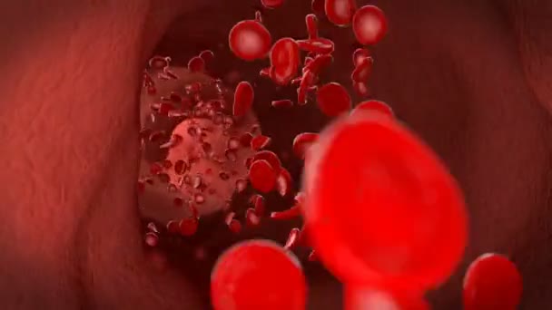 Röda blodkroppar erytrocyter flödet genom venen — Stockvideo