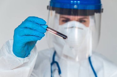 Korunaklı kıyafetli kadın doktor ya da hemşire Coronavirus ya da Cvid-19 için pozitif kan testi sonuçları tutuyor..