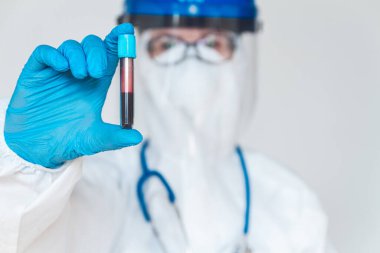 Korunaklı kıyafetli kadın doktor ya da hemşire Coronavirus ya da Cvid-19 için pozitif kan testi sonuçları tutuyor..