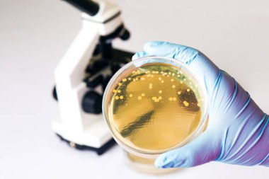El Petri kabına E.coli Escherichia ile bakteri mikroskop önünde tutar. Bağırsak enfeksiyonu için test. Bakteriyel koloni büyüme agar plaka, büyüyen cocci gram-negatif basiller, Alfa hemoliz