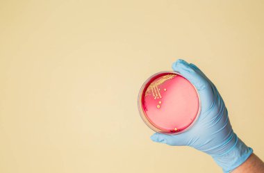 Hand holds Petri dish with Staphylococcus aureus bacteria. Medical lab testing for infection.Bacterial colony culture growth in blood agar plate, gram-positive cocci bacilli growing, beta hemolysis clipart