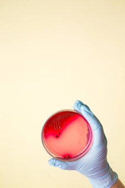 El Petri kabına Staphylococcus aureus bakteri ile tutar. Tıbbi laboratuvar enfeksiyon için test. Bakteriyel koloni kültür büyüme kan agar plaka, büyüyen gram-pozitif cocci basiller, beta hemoliz