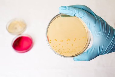 El Petri kabına E.coli Escherichia ile bakteri tutar. Enfeksiyon için sınama laboratuarı. Staphylococcus aureus bakteriyel koloni kültür büyüme, gram-pozitif cocci Ayagin Gram-negatif basiller, Alfa beta hemoliz