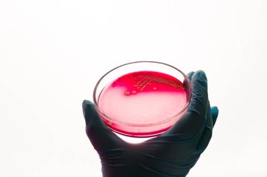 El Petri kabına Staphylococcus aureus bakteri ile tutar. Tıbbi laboratuvar enfeksiyon için test. Bakteriyel koloni kültür büyüme kan agar plaka, büyüyen gram-pozitif cocci basiller, beta hemoliz