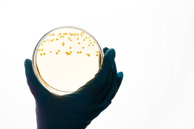 El Petri kabına E.coli Escherichia ile bakteri tutar. Bağırsak enfeksiyonu için sınama laboratuarı. Bakteriyel koloni kültür büyüme sarı agar plaka, büyüyen cocci Ayagin Gram-negatif basiller, Alfa hemoliz