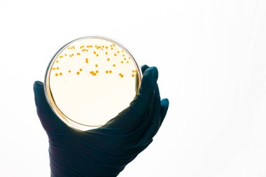 Hand holds Petri dish with E.coli Escherichia bacteria. Lab testing for intestinal infection.Bacterial colony culture growth in yellow agar plate, gram-negative cocci bacilli growing, alpha hemolysis clipart