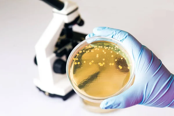 Hand Houdt Petrischaal Met Coli Escherichia Bacteriën Voor Microscoop Testen — Stockfoto