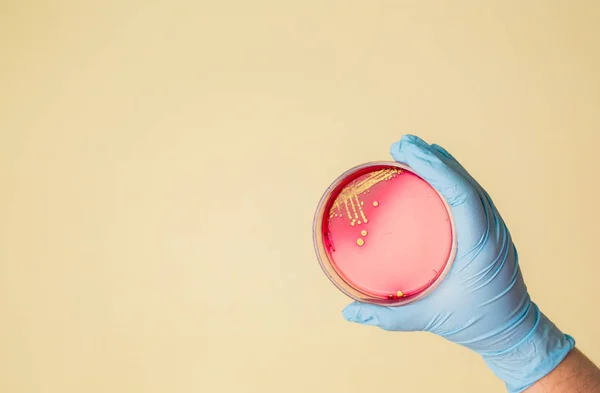 El Petri kabına Staphylococcus aureus bakteri ile tutar. Tıbbi laboratuvar enfeksiyon için test. Bakteriyel koloni kültür büyüme kan agar plaka, büyüyen gram-pozitif cocci basiller, beta hemoliz