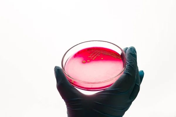 Hand Houdt Petrischaal Met Staphylococcus Aureus Bacteriën Medische Lab Testen — Stockfoto