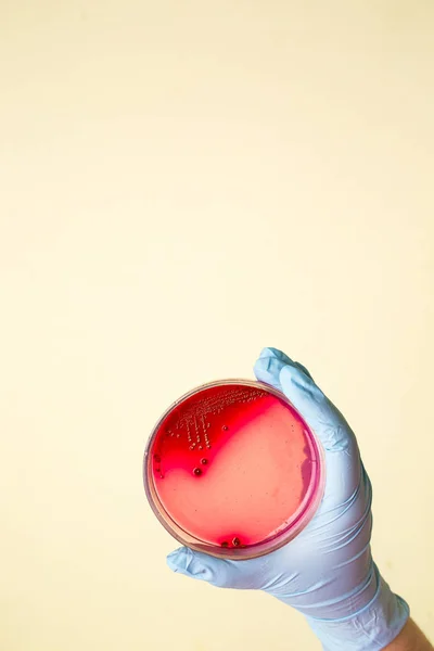 Mano Sostiene Placa Petri Con Bacterias Staphylococcus Aureus Análisis Laboratorio Imágenes de stock libres de derechos