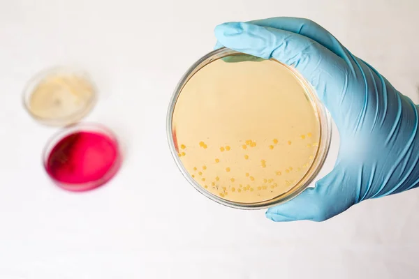 Mano Sostiene Placa Petri Con Bacteria Coli Escherichia Pruebas Laboratorio Imágenes De Stock Sin Royalties Gratis