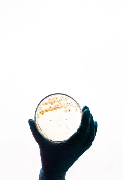 Mano Sostiene Placa Petri Con Bacteria Coli Escherichia Análisis Laboratorio Imagen De Stock