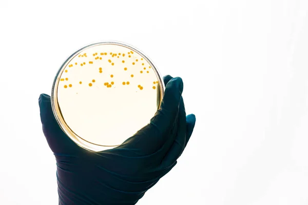 박테리아 대장균 Escherichia 접시를 보유합니다 감염에 테스트 연구실 세균성 식민지 스톡 이미지