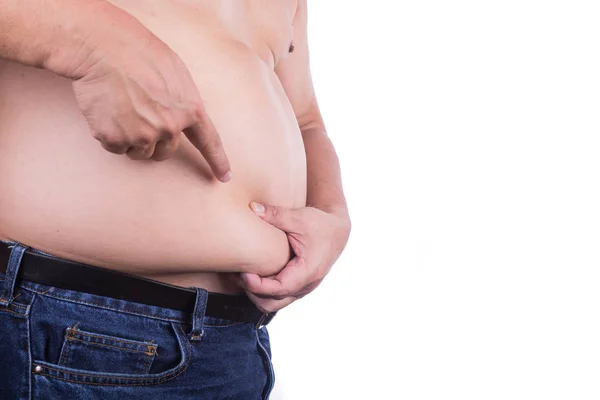 男人用内脏或皮下脂肪捏自己不健康的大肚 构成健康风险 — 图库照片