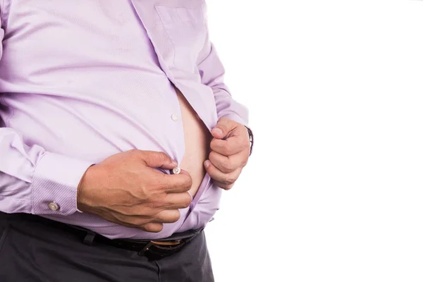 Mann Mit Ungesundem Dicken Bauch Knöpft Enges Hemd Auf Beschwerden — Stockfoto