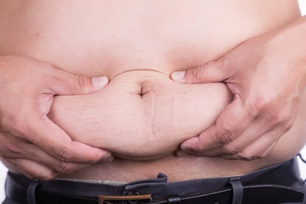 Zbliżenie Mężczyznę Trzymającego Niezdrowe Duży Brzuch Tłuszczu Trzewnego Tkanki Podskórnej — Zdjęcie stockowe