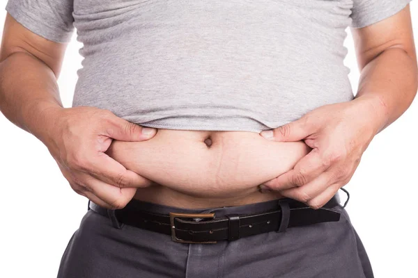 用内脏和皮下脂肪抓不健康大肚的人的特写 构成健康风险 — 图库照片