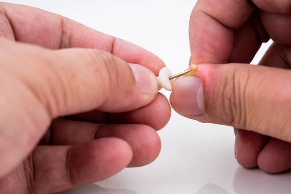 Serie de infección dolorosa de la piel de las uñas con tratamiento de pus — Foto de Stock