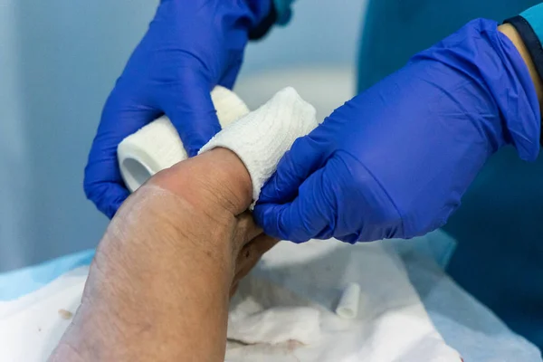 Trabajador Salud Enfermería Dedo Del Pie Con Vendaje Gauz Después — Foto de Stock