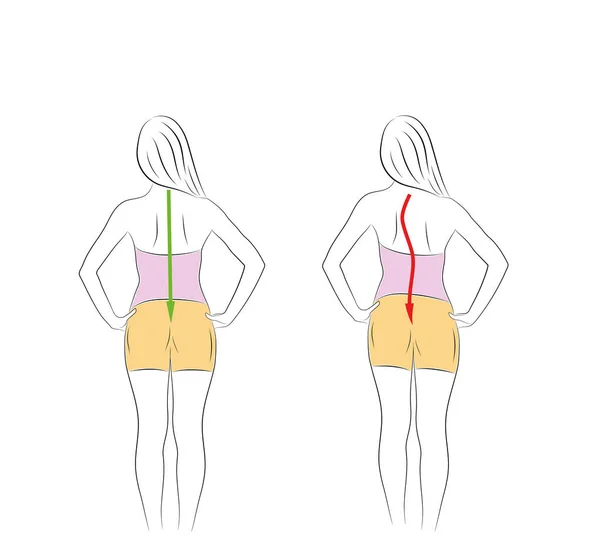 Alineación Correcta Del Cuerpo Humano Postura Pie Para Una Buena — Archivo Imágenes Vectoriales