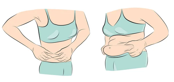 Frauen Mit Und Ohne Bauch Abnehmen Übergewicht Vektor — Stockvektor