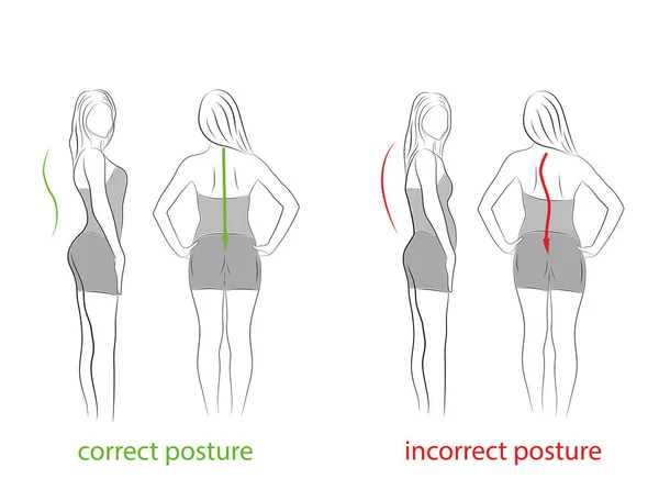 Postura Correcta Incorrecta Vista Lateral Trasera Recomendaciones Médicas Ilustración Vectorial — Archivo Imágenes Vectoriales